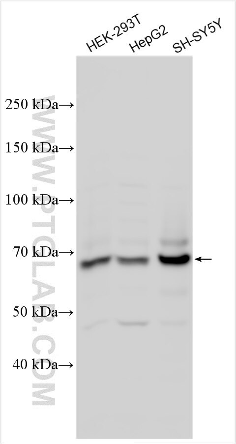 EPN2 Antibody in Western Blot (WB)