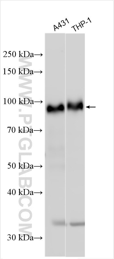 CD117/c-Kit Antibody in Western Blot (WB)