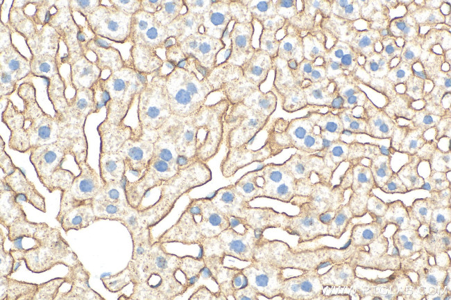 ASGR1 Antibody in Immunohistochemistry (Paraffin) (IHC (P))