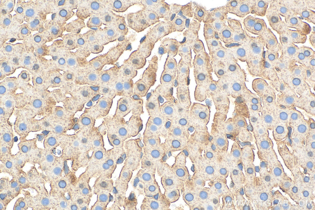 Albumin Antibody in Immunohistochemistry (Paraffin) (IHC (P))