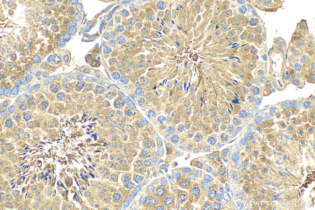 CFAP70 Antibody in Immunohistochemistry (Paraffin) (IHC (P))