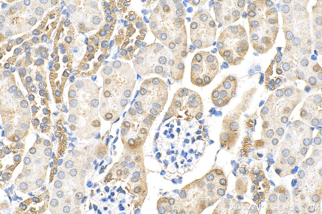 VWA8 Antibody in Immunohistochemistry (Paraffin) (IHC (P))