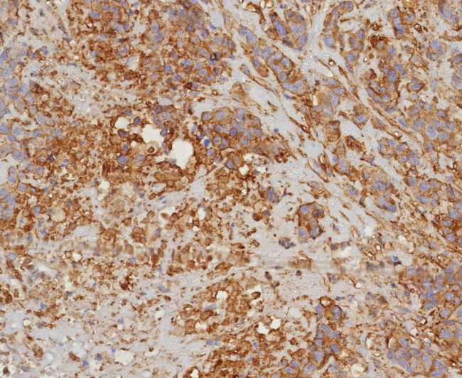 HLA-G (Major Histocompatibility Complex, class I, G) Antibody in Immunohistochemistry (Paraffin) (IHC (P))
