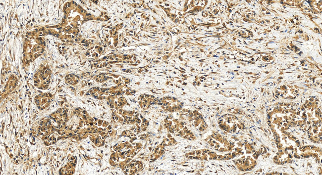 DFNA5/GSDME Antibody in Immunohistochemistry (Paraffin) (IHC (P))