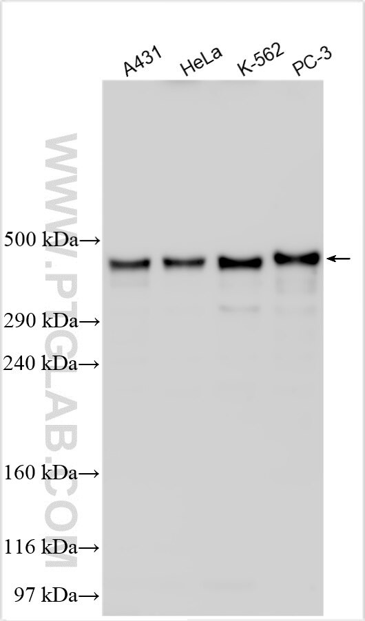 HTRA3 Antibody in Western Blot (WB)