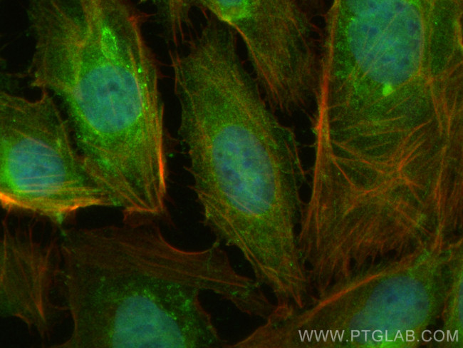 PSMA5 Antibody in Immunocytochemistry (ICC/IF)