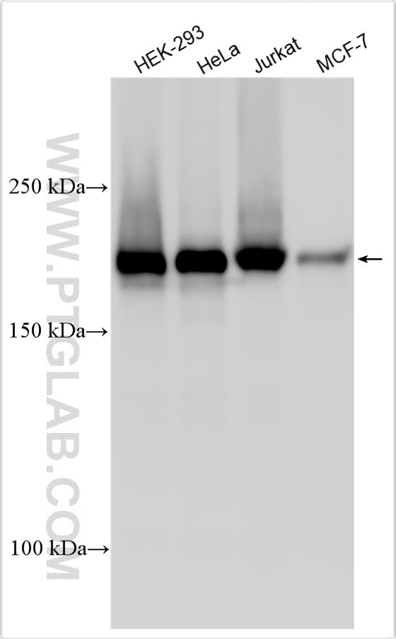 HOXB8 Antibody in Western Blot (WB)