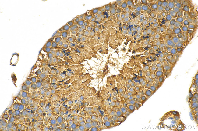 NEK4 Antibody in Immunohistochemistry (Paraffin) (IHC (P))
