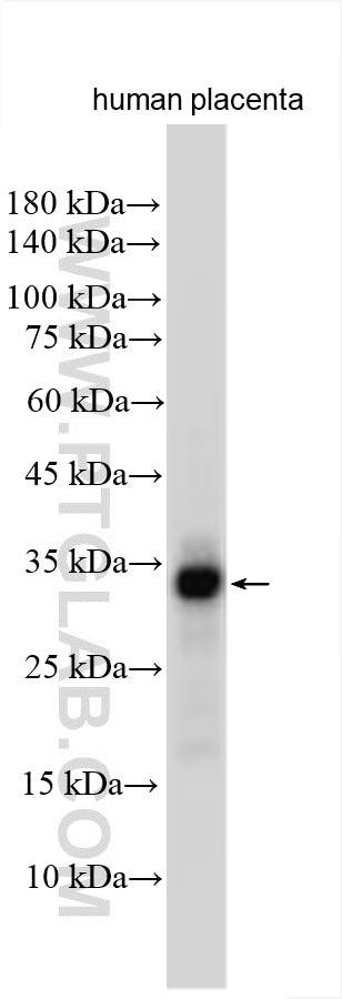 SBSPON Antibody in Western Blot (WB)