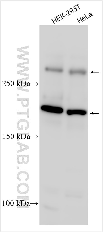 MLL4 Antibody in Western Blot (WB)