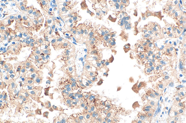 Cathepsin B Antibody in Immunohistochemistry (Paraffin) (IHC (P))
