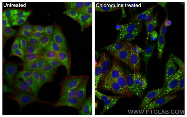 P62, SQSTM1 Antibody in Immunocytochemistry (ICC/IF)
