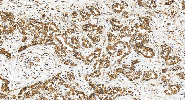 CMIP Antibody in Immunohistochemistry (Paraffin) (IHC (P))