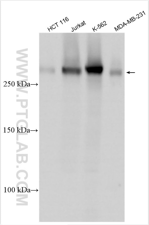 CABIN1 Antibody in Western Blot (WB)