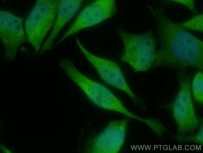 TUSC1 Antibody in Immunocytochemistry (ICC/IF)