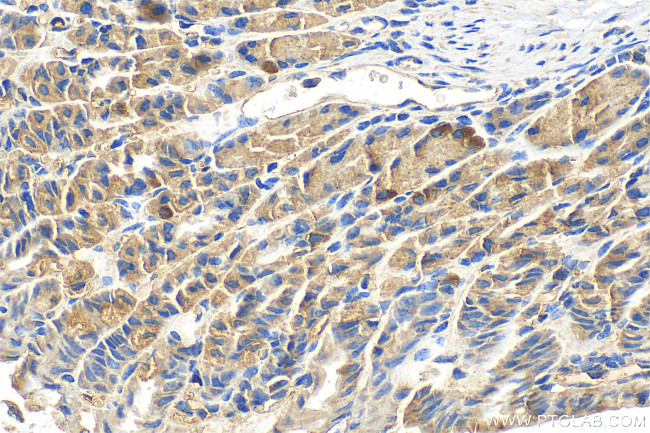 RAB13 Antibody in Immunohistochemistry (Paraffin) (IHC (P))
