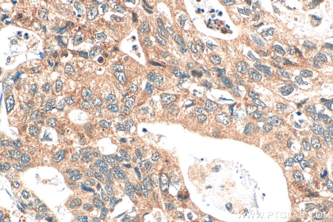 DPCR1 Antibody in Immunohistochemistry (Paraffin) (IHC (P))