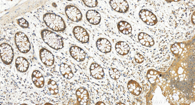 NDRG3 Antibody in Immunohistochemistry (Paraffin) (IHC (P))
