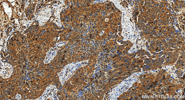 CORO7 Antibody in Immunohistochemistry (Paraffin) (IHC (P))