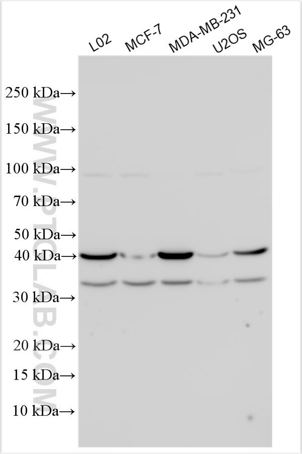 SLC2A4RG Antibody in Western Blot (WB)