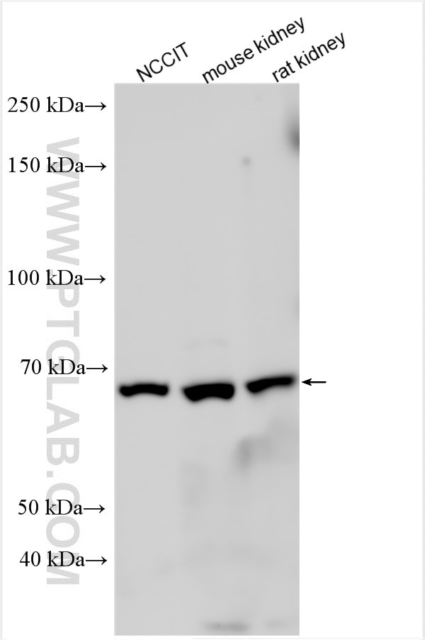 EYA1 Antibody in Western Blot (WB)