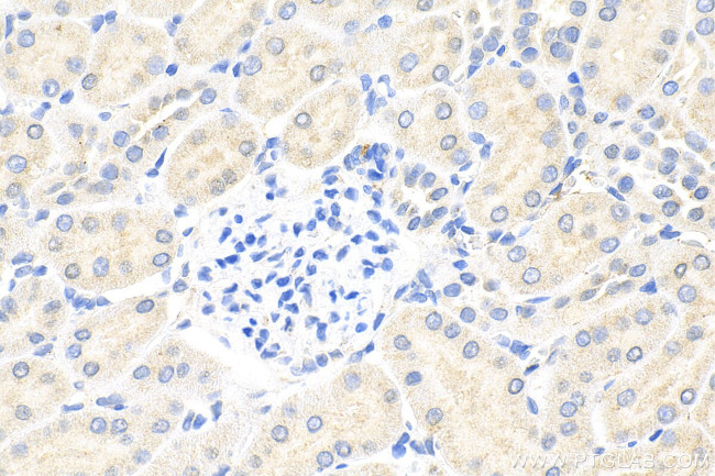 SLC8A2 Antibody in Immunohistochemistry (Paraffin) (IHC (P))