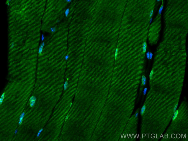 TMEM109 Antibody in Immunohistochemistry (Paraffin) (IHC (P))