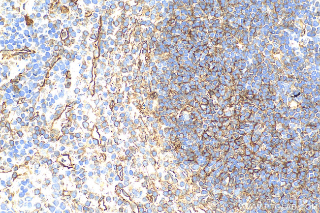 CD200 Antibody in Immunohistochemistry (Paraffin) (IHC (P))