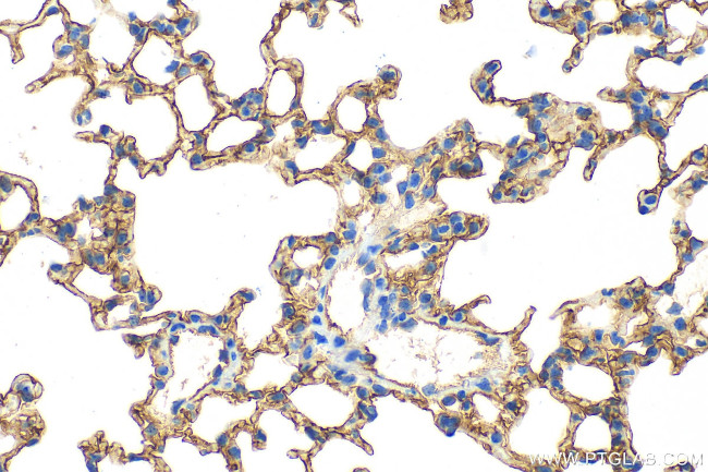 ICAM-1/CD54 Antibody in Immunohistochemistry (Paraffin) (IHC (P))