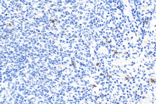 Lipocalin-2/Ngal Antibody in Immunohistochemistry (Paraffin) (IHC (P))