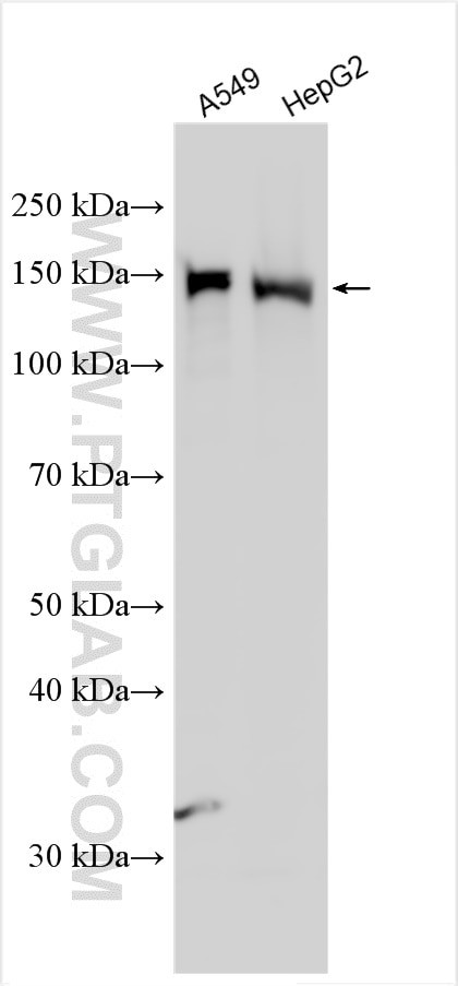 IBTK Antibody in Western Blot (WB)