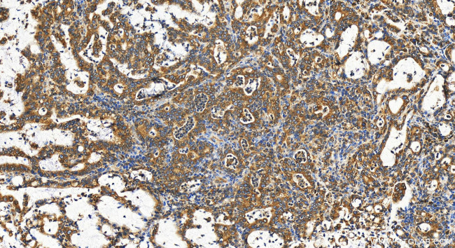HSD17B12 Antibody in Immunohistochemistry (Paraffin) (IHC (P))