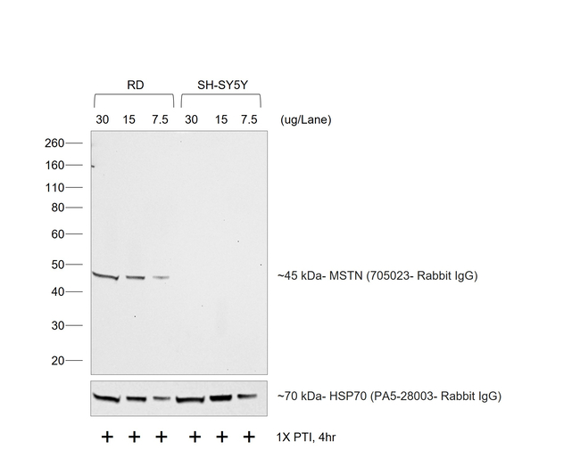 Rabbit IgG (H+L) Secondary Antibody in Western Blot (WB)