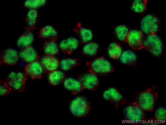 E2F6 Antibody in Immunocytochemistry (ICC/IF)