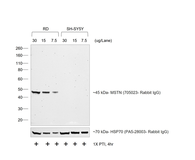Rabbit IgG (H+L) Secondary Antibody in Western Blot (WB)