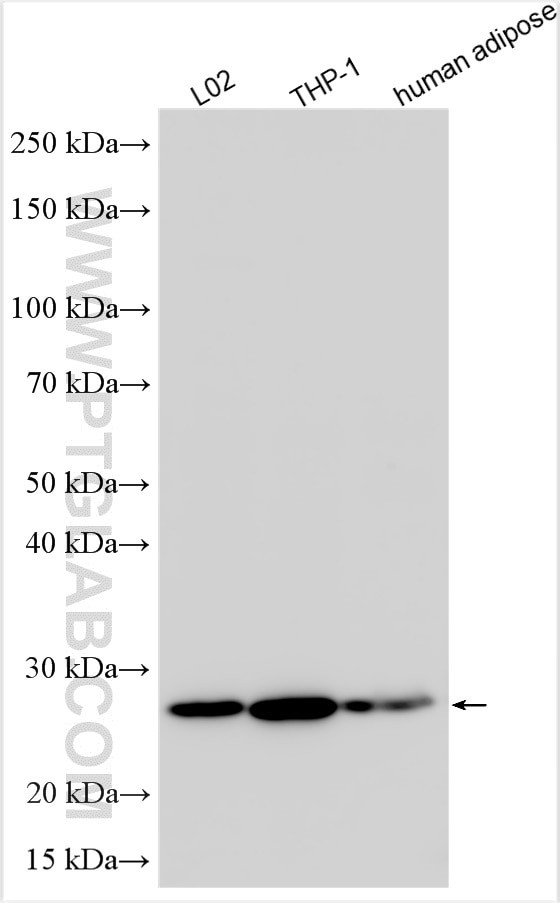 AGPAT2 Antibody in Western Blot (WB)
