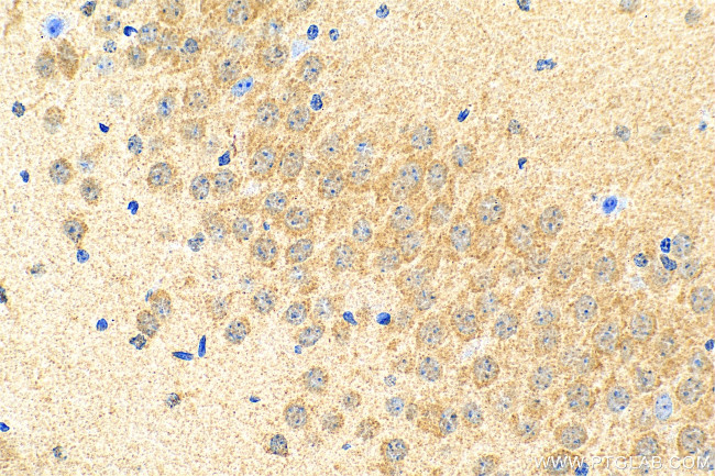 SLC38A7 Antibody in Immunohistochemistry (Paraffin) (IHC (P))