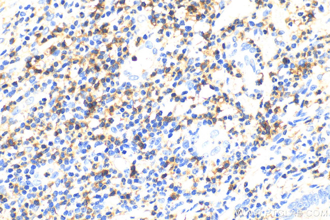 CD5 Antibody in Immunohistochemistry (Paraffin) (IHC (P))