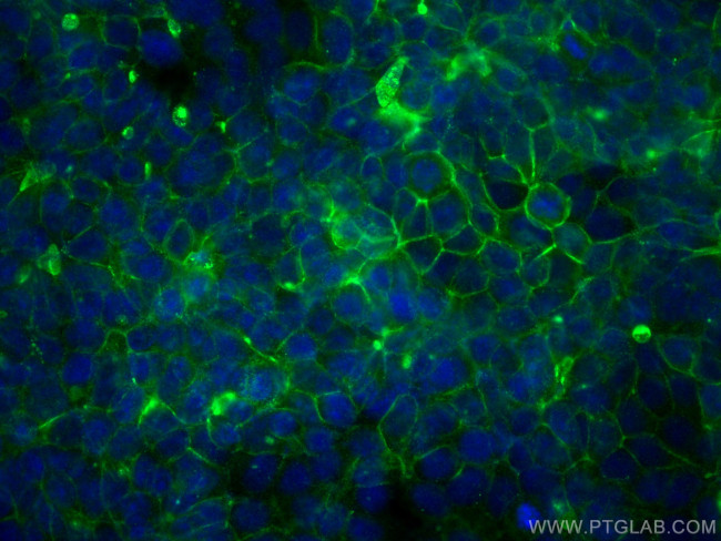 CD9 Antibody in Immunocytochemistry (ICC/IF)