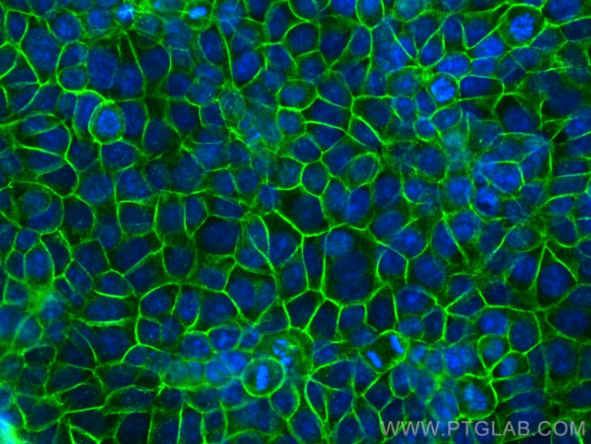 E-cadherin Antibody in Immunocytochemistry (ICC/IF)