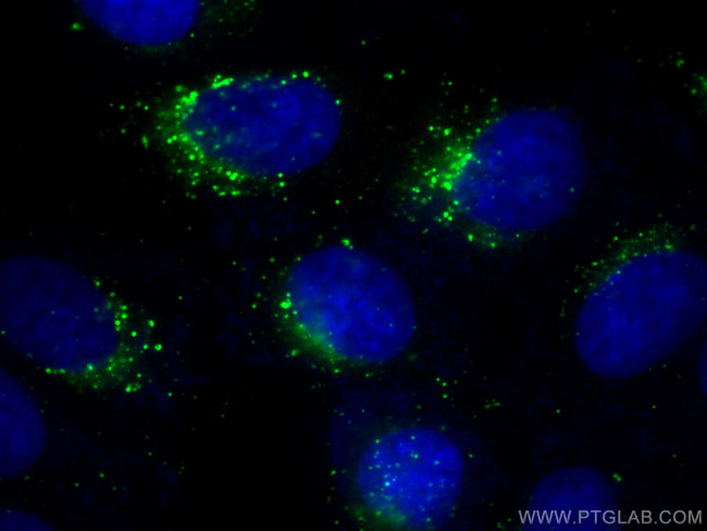 Cathepsin D Antibody in Immunocytochemistry (ICC/IF)
