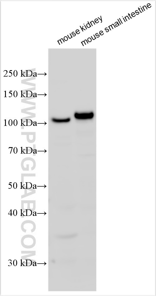 ACE2 Antibody in Western Blot (WB)
