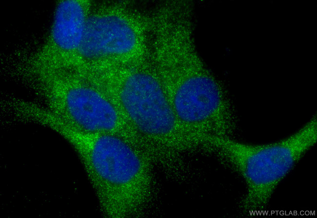 EXOC8 Antibody in Immunocytochemistry (ICC/IF)