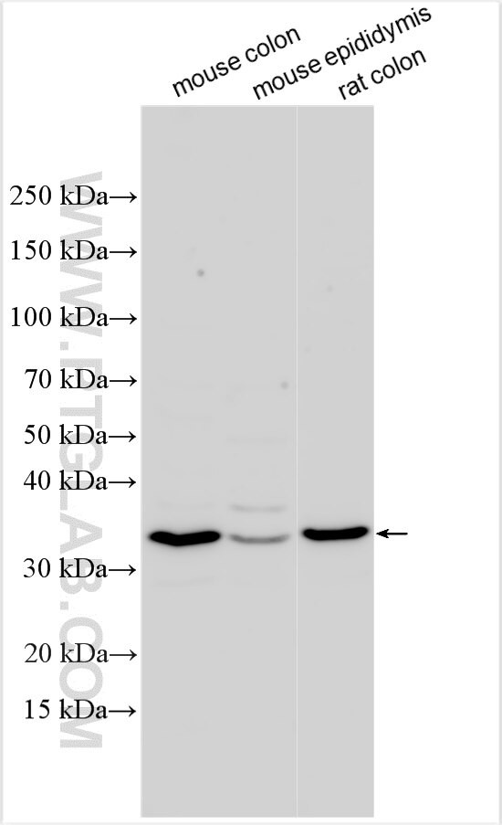 TMEM258 Antibody in Western Blot (WB)