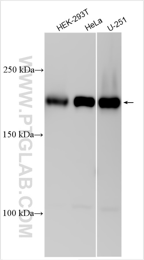 CDC42BPB Antibody in Western Blot (WB)