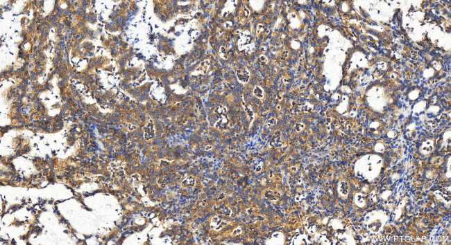 PPP1R21 Antibody in Immunohistochemistry (Paraffin) (IHC (P))