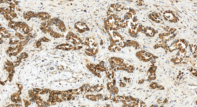CXCL8/IL-8 Antibody in Immunohistochemistry (Paraffin) (IHC (P))