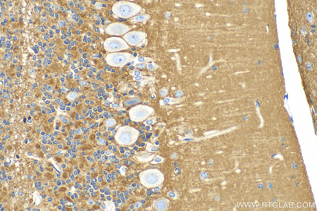 NCAM1/CD56 Antibody in Immunohistochemistry (Paraffin) (IHC (P))