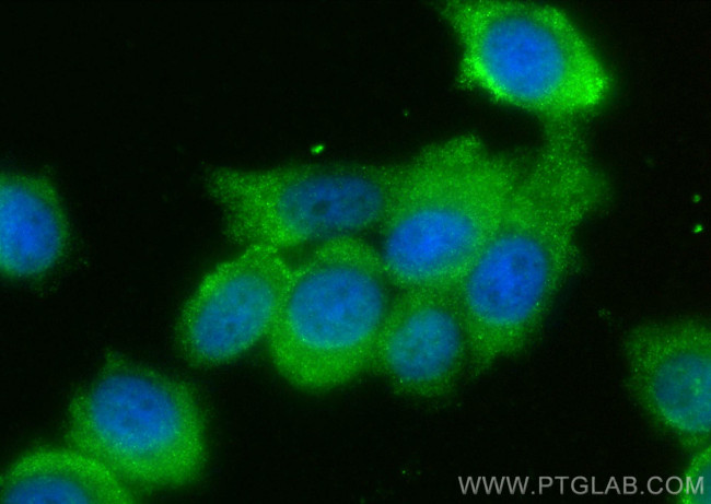 ATPBD3 Antibody in Immunocytochemistry (ICC/IF)
