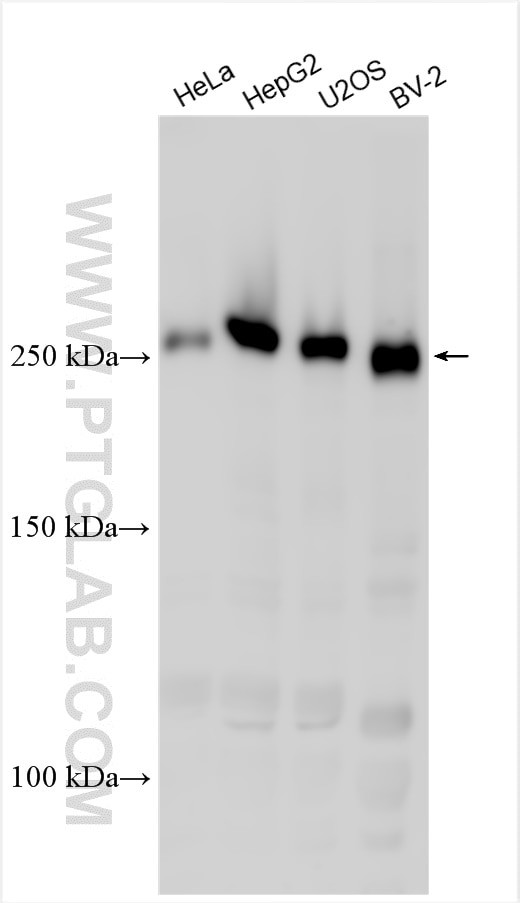 LMTK2 Antibody in Western Blot (WB)